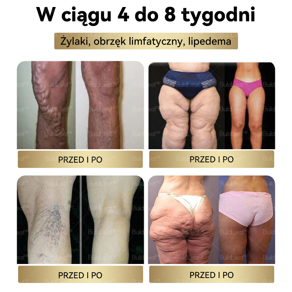 Zalecane przez Mayo Clinic | Oficjalny sklep | BuildLeaf® TIRZEPATIDE GLP-1 Ziołowy Płyn Doustny